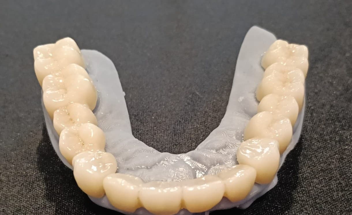 Puente de zirconia monolítica